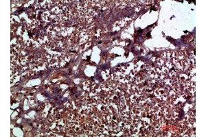 Immunohistochemical analysis of paraffin-embedded human-pancreas, antibody was diluted at 1:200 (IL17C 抗体  (AA 81-130))