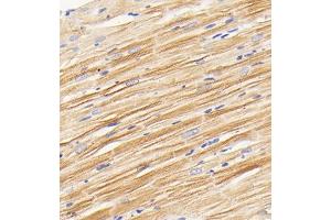 Immunohistochemistry analysis of paraffin embedded rat heart using PDK3 (ABIN7075334) at dilution of 1: 2000 (PDK3 抗体)