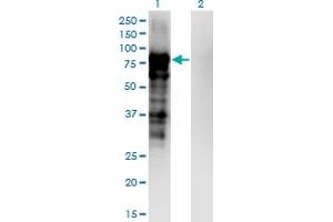 Western Blot analysis of PKP3 expression in transfected 293T cell line by PKP3 monoclonal antibody (M04), clone 6E5. (Plakophilin 3 抗体  (AA 225-324))