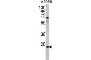 Western Blotting (WB) image for anti-Growth Factor Receptor-Bound Protein 2 (GRB2) antibody (ABIN3002593) (GRB2 抗体)