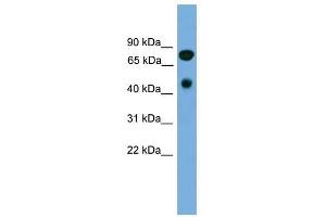 RIPK4 antibody used at 1 ug/ml to detect target protein.
