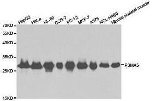 Western Blotting (WB) image for anti-Proteasome Subunit alpha 6 (PSMA6) antibody (ABIN1874369) (PSMA6 抗体)