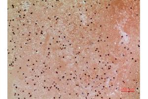 Immunohistochemistry (IHC) analysis of paraffin-embedded Human Colon, antibody was diluted at 1:100.