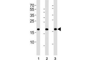 Western blot analysis of lysate from HepG2, NCCIT, mouse NIH3T3 cell line (left to right) using HMGA2 antibody; Ab was diluted at 1:1000 for each lane.