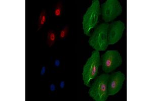 ABIN7094722 and ABIN7098773 staining  cells by IF/ICC.