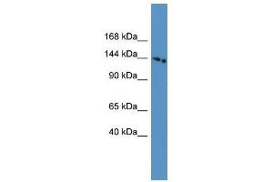 Western Blot showing SLC4A5 antibody used at a concentration of 1-2 ug/ml to detect its target protein. (NBC4 抗体  (N-Term))