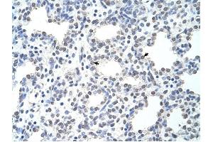 MCM6 antibody was used for immunohistochemistry at a concentration of 4-8 ug/ml to stain Alveolar cells (arrows) in Human Lung.
