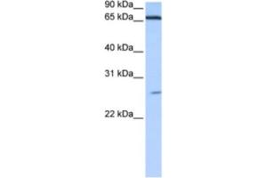 Western Blotting (WB) image for anti-Zinc Finger Protein 879 (ZNF879) antibody (ABIN2463464) (ZNF879 抗体)