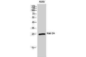 Western Blotting (WB) image for anti-RAB2A, Member RAS Oncogene Family (RAB2A) (Internal Region) antibody (ABIN3186617)