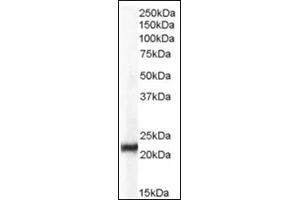 Image no. 2 for anti-Chromobox Homolog 5 (CBX5) (Internal Region) antibody (ABIN374617) (CBX5 抗体  (Internal Region))