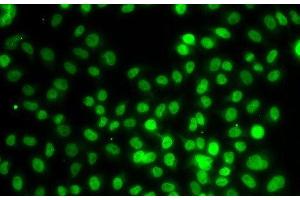 Immunofluorescence analysis of MCF-7 cells using SETD8 Polyclonal Antibody
