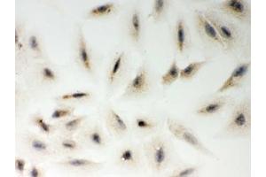 Immunocytochemistry (ICC) image for anti-Metadherin (MTDH) (AA 101-270) antibody (ABIN3031760)
