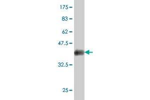 Western Blot detection against Immunogen (38. (MKNK2 抗体  (AA 41-158))