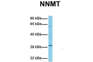 Host:  Rabbit  Target Name:  NNMT  Sample Tissue:  Human Hela  Antibody Dilution:  1. (NNMT 抗体  (N-Term))