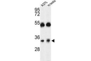 Western Blotting (WB) image for anti-ORAI Calcium Release-Activated Calcium Modulator 1 (ORAI1) antibody (ABIN3004147) (ORAI1 抗体)