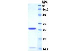 SDS-PAGE of Protein Standard from the Kit (Highly purified E. (Ki-67 ELISA 试剂盒)