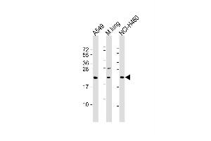 Western Blot at 1:2000 dilution Lane 1: A549 whole cell lysate Lane 2: mouse lung lysate Lane 3: NCI-H460 whole cell lysate Lysates/proteins at 20 ug per lane.