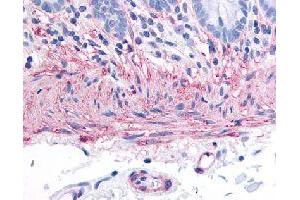 Immunohistochemical (Formalin/PFA-fixed paraffin-embedded sections) staining in human colon (smooth muscle) with TACR2 polyclonal antibody . (TACR2 抗体)
