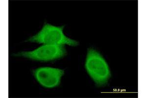 Immunofluorescence of purified MaxPab antibody to CAST on HeLa cell. (Calpastatin 抗体  (AA 1-667))