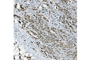 IHC analysis of RAB1B using anti-RAB1B antibody (ABIN7602809). (RAB1B 抗体  (C-Term))