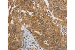 Immunohistochemistry (IHC) image for anti-Protein tyrosine Phosphatase, Non-Receptor Type 11 (PTPN11) (AA 514-593) antibody (ABIN3016707)