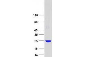 Western Blotting (WB) image for Processing of Precursor 7, Ribonuclease P/MRP Subunit (POP7) protein (Myc-DYKDDDDK Tag) (ABIN2729368)