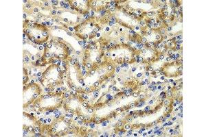 Immunohistochemistry of paraffin-embedded Mouse kidney using DGKE Polyclonal Antibody at dilution of 1:100 (40x lens). (DGKE 抗体)