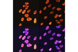 Immunofluorescence analysis of C6 cells using Acetyl-Histone H4-K5 antibody (ABIN7267743).