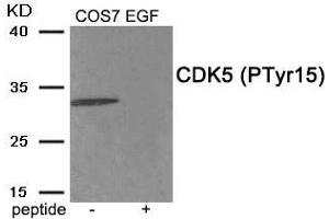Western blot analysis of extracts from COS7 cells treated with EGF using Phospho-CDK5 (Tyr15) antibody. (CDK5 抗体  (pTyr15))