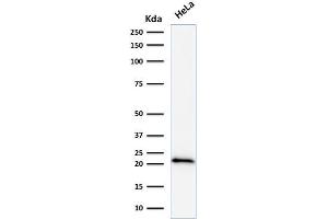 Western Blot Analysis of human HeLa cell lysate using p21 Mouse Monoclonal Antibody (DCS-60. (p21 抗体)