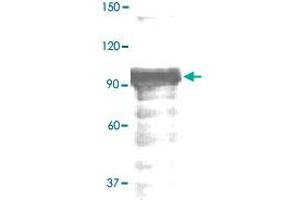 The whole tissue lysate derived from mouse kidney was immunoblotted by STAT4 (phospho Y693) polyclonal antibody  at 1 : 500.