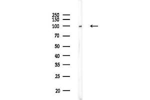 anti-alpha-Actinin Skeletal Muscle (ACTN) (N-Term) antibody
