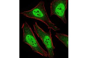 Fluorescent ige of Hela cells stained with D2L2 Antibody (C-term) (ABIN6243877 and ABIN6577436). (MAD2L2 抗体  (C-Term))