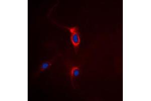 Immunofluorescent analysis of mGLUR4 staining in HeLa cells. (Metabotropic Glutamate Receptor 4 抗体  (C-Term))