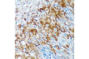 Immunohistochemistry of paraffin-embedded Human esophageal using IER5 Rabbit pAb (ABIN7267843) at dilution of 1:100 (40x lens). (IER5 抗体)