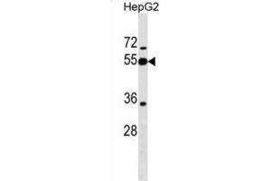 Western Blotting (WB) image for anti-Peptidase Inhibitor 16 (PI16) antibody (ABIN2999664)