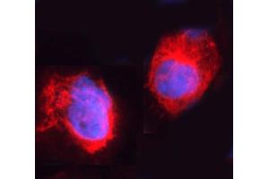 IF analysis of ARHGEF1 using anti-ARHGEF1 antibody (ABIN4886475).