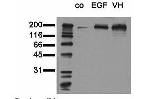 Phosphospecificity: Whole cell extracts of control (co), EGF stimulated (EGF) or pervanadate treated (VH) A549 tumor cells were applied to SDS-PAGE (20,000 cells per lane) and transferred to a PVDF membrane. (EGFR 抗体  (pTyr1173))