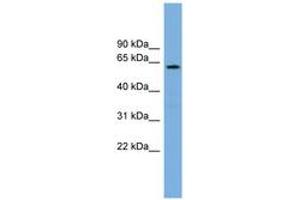 Image no. 1 for anti-Cytochrome P450, Family 26, Subfamily B, Polypeptide 1 (CYP26B1) (AA 35-84) antibody (ABIN6744175)