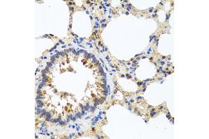Immunohistochemistry of paraffin-embedded rat lung using LRG1 antibody. (LRG1 抗体)