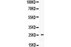 Western blot analysis of Prolactin expression in mouse testis extract (lane 1).