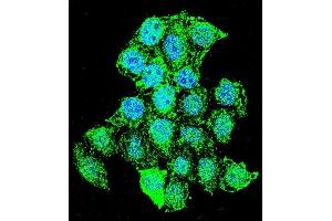 Confocal immunofluorescent analysis of ZMYND17 Antibody (C-term) (ABIN655547 and ABIN2845056) with Hela cell followed by Alexa Fluor 488-conjugated goat anti-rabbit lgG (green).