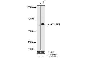 Western blot analysis of extracts of Jurka cells, using Phospho--S473 antibody (ABIN3019619, ABIN3019620, ABIN3019621 and ABIN1681366) at 1:1000 dilution. (AKT1 抗体  (pSer473))
