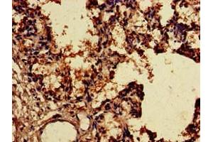 Immunohistochemistry of paraffin-embedded human lung tissue using ABIN7170356 at dilution of 1:100 (SNX15 抗体  (AA 144-321))