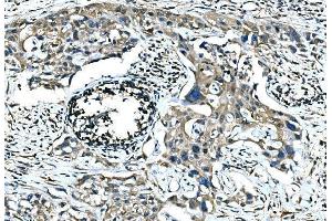 IHC analysis of Calponin 2/CNN2 using anti-Calponin 2/CNN2 antibody (ABIN7602856). (CNN2 抗体  (C-Term))