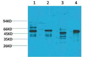 Western Blot (WB) analysis of 1) Rat Brain Tissue, 2)Mouse Brain Tissue, 3) K562, 4) HepG2 with KCNN4(SK4) Rabbit Polyclonal Antibody diluted at 1:2000.