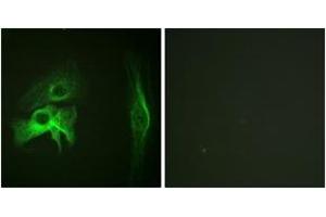 Immunofluorescence analysis of HeLa cells, using PAK1 (Ab-212) Antibody. (PAK1 抗体  (AA 178-227))