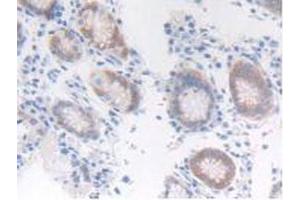 IHC-P analysis of Human Stomach Tissue, with DAB staining. (FGFRL1 抗体  (AA 168-378))
