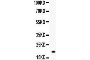 Western Blotting (WB) image for anti-O6-Methylguanine-DNA-Methyltransferase (MGMT) (AA 2-207) antibody (ABIN3042363)