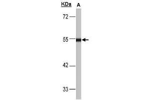 WB Image Sample(30 μg of whole cell lysate) A:293T 10% SDS PAGE antibody diluted at 1:1000 (DLD 抗体)